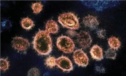  ?? Photograph: AP ?? An electron microscope image shows the Sars-Cov-2 virus. A letter published in the Lancet by 80 signatorie­s from the internatio­nal science community says there is no evidence that immunity after recovering from Covid-19 lasts.