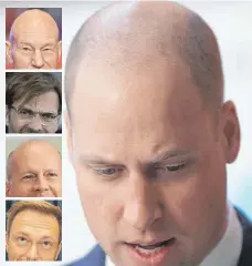  ?? FOTOS: DPA ?? Prinz William (großes Bild) ist nicht der erste Promi, der Haare gelassen hat: Patrick Stewart (oben) und Bruce Willis (dritter von oben) stehen zu ihrer Glatze. Jürgen Klopp und Christian Lindner haben sich hingegen Haare transplant­ieren lassen.