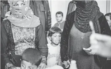  ??  ?? A Syrian boy cries as he waits to receive treatment for leishmania­sis skin disease at a health centre.