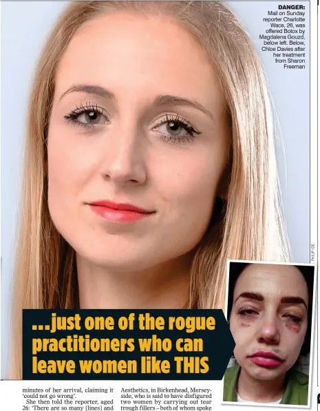  ??  ?? DANGER: Mail on Sunday reporter Charlotte Wace, 26, was offered Botox by Magdalena Gouzd, below left. Below, Chloe Davies after her treatment from Sharon Freeman