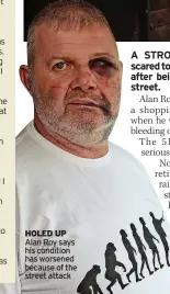  ?? ?? HOLED UP Alan Roy says his condition has worsened because of the street attack