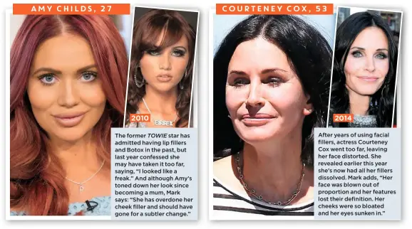  ??  ?? says: “She has overdone her cheek filler and should have gone for a subtler change.” lost their definition. Her cheeks were so bloated and her eyes sunken in.” The former TOWIE star has admitted having lip fillers and Botox in the past, but last year confessed she may have taken it too far, saying, “I looked like a freak.” And although Amy’s toned down her look since becoming a mum, Mark After years of using facial fillers, actress Courteney Cox went too far, leaving her face distorted. She revealed earlier this year she’s now had all her fillers dissolved. Mark adds, “Her face was blown out of proportion and her features