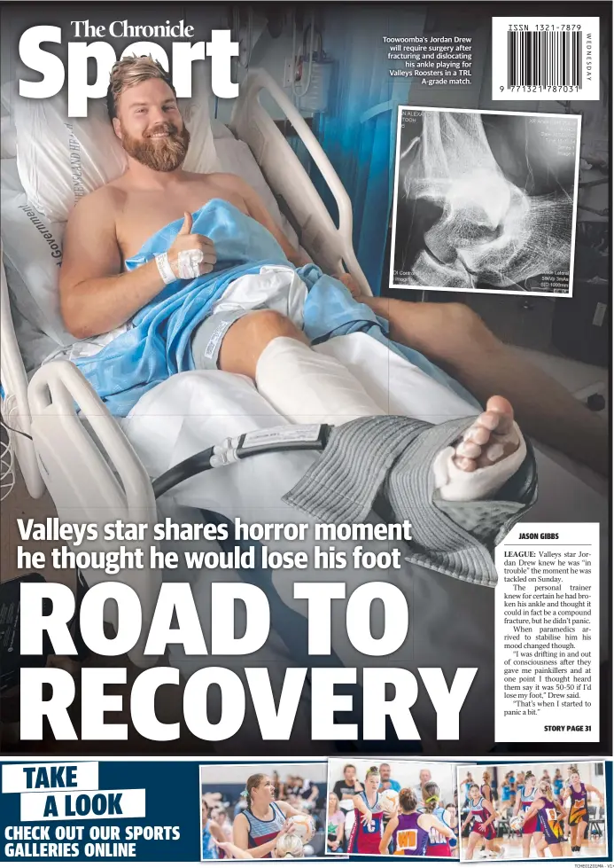  ?? ?? Toowoomba's Jordan Drew will require surgery after fracturing and dislocatin­g his ankle playing for Valleys Roosters in a TRL A-grade match.