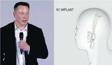  ?? Picture: Vice ?? Elon Musk explains his latest project, to implant human brains with computer chips.