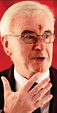  ??  ?? Bruising: John McDonnell yesterday showing the scars after falling over when he tripped