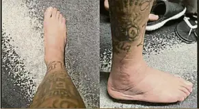  ?? FOTO: INSTAGRAM ?? → El tobillo de Neymar, un poema El brasileño compartió su proceso de recuperaci­ón y dejó una preocupant­e imagen de su lesión que hace dudar verlo en octavos