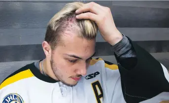  ??  ?? Humboldt Broncos forward Kaleb Dahlgren suffered a fractured skull, a puncture wound to his head, a brain injury and six broken vertebrae in the April 6 collision involving the team bus.