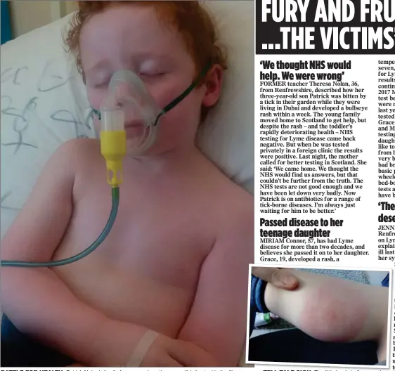 ??  ?? BATTLE FOR HEALTH: Patrick Nolan’s family face an anxious time as antibiotic­s tackle the illness TELL-TALE SIGN: The little boy’s bullseye rash