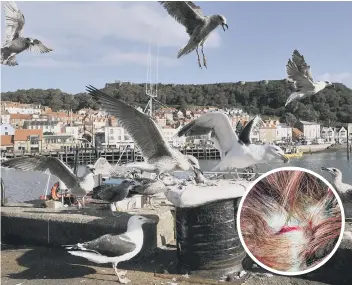  ?? PICTURE: RICHARD PONTER ?? Gulls in Scarboroug­h where attacks have increasded. Inset a head wound caused by a gull