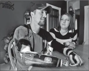  ?? The Associated Press ?? FARM INJURIES: In this Feb. 25, 2014, file photo, Little Falls, Minn., resident Jamie Houdek, with his wife, Lisa, at his side, talks about his recovery after he lost his right hand to a corn picker in November 2013 on the 60-acre hobby farm where he...