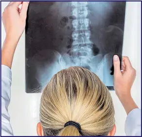  ?? Picture: GETTY ?? ENOUGH ON YOUR PLATE: An X-ray of your spine could provide an answer