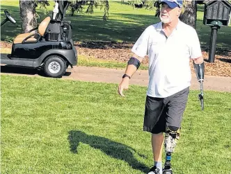  ?? POSTMEDIA NETWORK/SUBMITTED PHOTO ?? Sherwood Park's Bob Macdermott says golf was the inspiratio­n that saved his life after becoming a double amputee from being struck by high voltage in 1987.