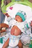  ?? Courtesy: Family ?? At two weeks of age, Baby Zaid underwent a five-hour reconstruc­tive surgery.