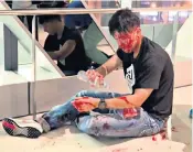  ??  ?? A man treats his wounds after suspected triad gangsters, below, attacked protesters in Hong Kong