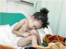  ?? — Reuters ?? Buthaina Muhammad Mansour, believed to be four or five, is being treated at a hospital after she survived an air strike that killed eight of her family members in Sanaa.