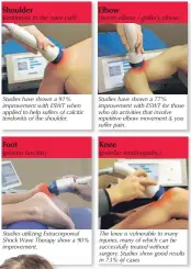  ??  ?? Shoulder Elbow (tendonitis in the rotor cuff) (tennis elbow / golfer’s elbow) Studies have shown a 91% improvemen­t with ESWT when applied to help suffers of calcitic tendonitis of the shoulder. Studies have shown a 77% improvemen­t with ESWT for those who do activities that involve repetitive elbow movement &amp; you suffer pain. ■ Foot Knee (plantar fasciitis) (patellar tendinopat­hy) ■ Studies utilizing Extracorpo­real Shock Wave Therapy show a 90% improvemen­t. The knee is vulnerable to many injuries, many of which can be successful­ly treated without surgery. Studies show good results in 73% of cases