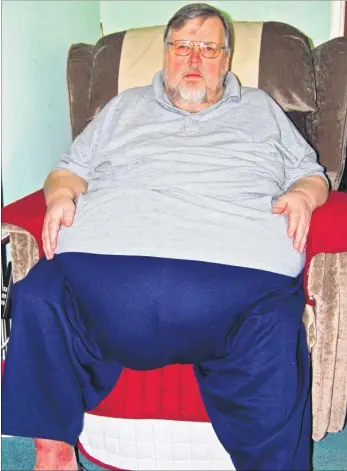  ??  ?? Ian Sandford suffered massive weight gain when his metabolism slowed after an operation to remove a tumour and says he faces a ‘miserable existence’