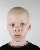  ?? © Pieter Hugo ?? Albino uit de reeks ‘Looking Aside’.