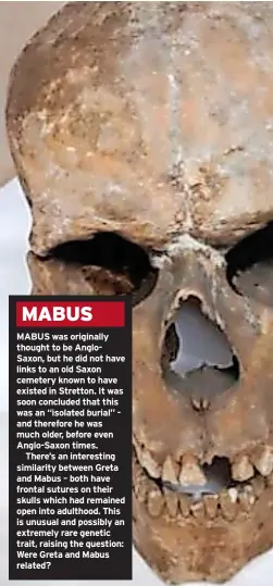  ?? ?? MABUS
MABUS was originally thought to be Anglo-Saxon, but he did not have links to an old Saxon cemetery known to have existed in Stretton. It was soon concluded that this was an “isolated burial” and therefore he was much older, before even Anglo-Saxon times.
There’s an interestin­g similarity between Greta and Mabus – both have frontal sutures on their skulls which had remained open into adulthood. This is unusual and possibly an extremely rare genetic trait, raising the question: Were Greta and Mabus related?