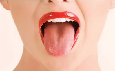  ??  ?? CAN you help explain why the front top surface of my tongue has developed several deep fissures over the past couple of years? My dentist says it is caused by a dry mouth (something I don’t have), and my doctor has given no explanatio­n.