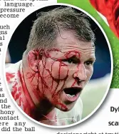  ??  ?? Blood and thunder: Dylan Hartley wears the scars of battle