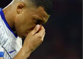  ?? Thilo Schmuelgen / REUTERS ?? Kylian Mbappé, blessé au nez.