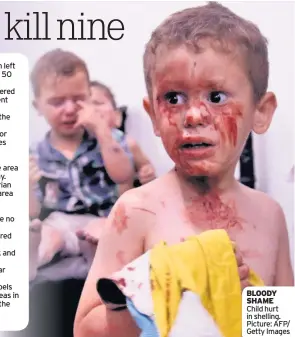  ??  ?? BLOODY SHAME Child hurt in shelling. Picture: AFP/ Getty Images