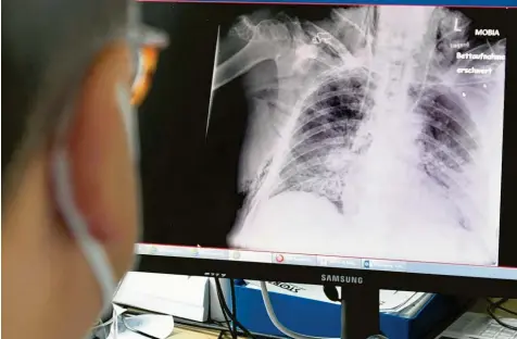  ?? Symbolfoto: Ulrich Wagner ?? Die Lunge eines Covid‰Patienten. Mittlerwei­le sind in Deutschlan­d mehr als 65 000 Menschen in Zusammenha­ng mit Corona gestorben. Bei Obduktione­n soll geklärt werden, ob die Infektion die Hauptursac­he war.