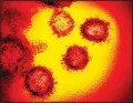  ?? (AP) ?? This undated electron microscope image made available by the US National Institutes of Health in February 2020 shows the novel coronaviru­s SARS-CoV-2. Also known as 2019-nCoV, the virus causes
COVID-19.