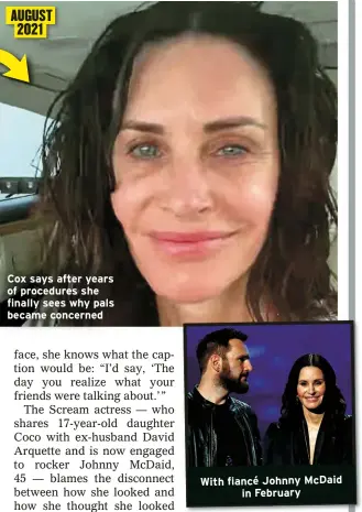  ?? ?? Cox says after years of procedures she finally sees why pals became concerned
With fiancé Johnny McDaid
in February