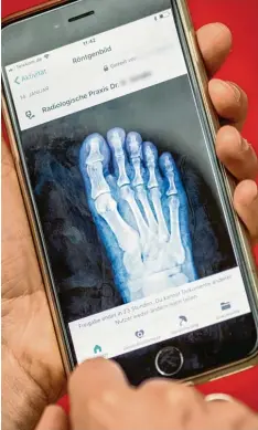  ?? Foto: Michael Kappeler, dpa ?? Ein Röntgenbil­d eines Fußes, angezeigt mithilfe der neuen digitalen Gesundheit­sapp mit dem Namen „Vivy“.