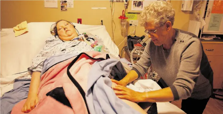  ?? GREG SOUTHAM/EDMONTON JOURNAL ?? Massage therapist Fay Pytel understand­s why Misty Franklin wants to come off her ventilator. “The fact that she’s a quadripleg­ic and can feel all the pain,” she said. “Most can’t.”