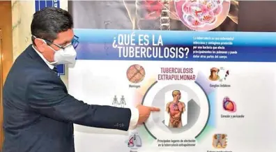  ?? Cedida ?? En el 2021 Panamá reportó 1,700 casos de tuberculos­is, y falleciero­n 177 ciudadanos.