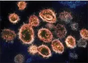  ?? FILE PHOTO - NIAID-RML VIA AP ?? SARSCoV-2 virus particles which causes COVID-19 emerging from the surface of cells cultured in a lab.