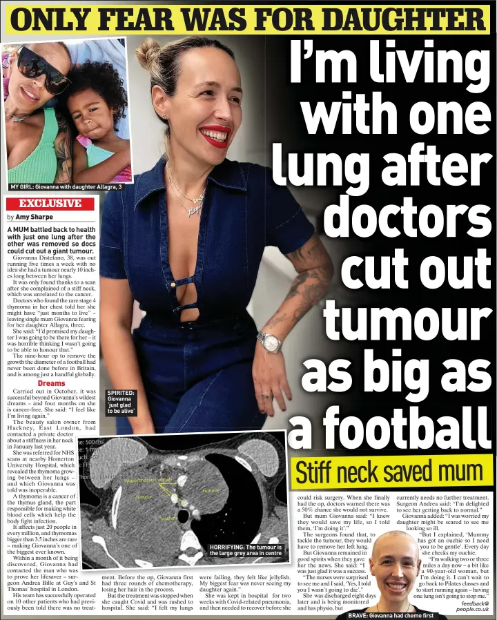  ?? ?? SPIRITED: Giovanna ‘just glad to be alive’
HORRIFYING: The tumour is the large grey area in centre