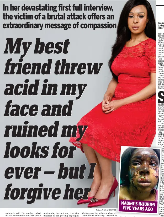  ?? Picture: RHIAN AP GRUFFYDD ?? Courageous: Naomi Oni today, aged 25, and (inset) after the acid attack NAOMI’S INJURIES FIVE YEARS AGO