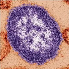  ?? Cynthia Goldsmith/Centers for Disease Control and Prevention via Associated Press ?? A measles virus particle under an electron miscroscop­e. Measles outbreaks in the U.S. and abroad are raising health experts’ concern about the preventabl­e childhood virus.