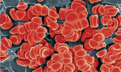  ?? Photograph: Science Photo Library/Alamy ?? ‘We urgently need to invest in more research and clinical trials to better understand and further confirm the link between abnormal blood clotting, hypoxia and vascular dysfunctio­n in patients with long Covid.’