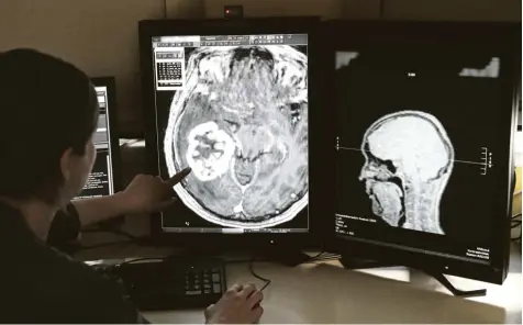  ?? Foto: Bernd Wüstneck, dpa ?? Krebs ist eine Geißel der Menschheit. Das Bild entstand in der radiologis­chen Abteilung der Universitä­tsmedizin in Rostock, wo mithilfe der Magnetreso­nanztomogr­aphie ein Tumor dargestell­t wird.
