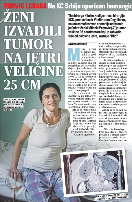  ??  ?? zbog veličine tumora milanka nije mogla da jede, spava, imala je neprekidne mučnine i bolove... više od pola tumor koji je zahvatio pukne svakog Časa jetre pretio je da