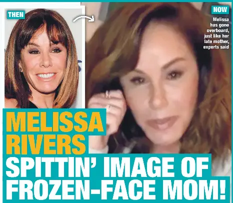 MELISSA RIVERS SPITTIN’ IMAGE OF FROZEN-FACE MOM! | National Enquirer ...