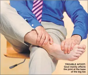  ?? Picture: GETTY ?? TROUBLE AFOOT: Gout mainly affects the joint at the base of the big toe