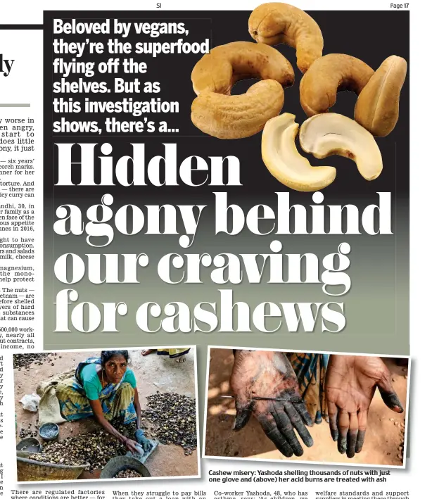  ??  ?? Cashew misery: Yashoda shelling thousands of nuts with just one glove and (above) her acid burns are treated with ash