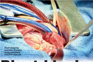  ??  ?? Heart stopping moment: Surgery being performed on a one-year-old