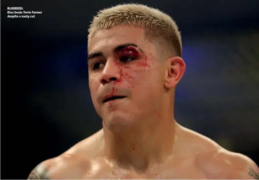  ?? Photo: MICHAEL REAVES/GETTY IMAGES ?? BLOODIED: Diaz beats Tevin Farmer despite a nasty cut