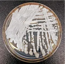  ?? CDC VIA THE NEW YORK TIMES ?? Cultured Candida auris in a petri dish. Resistant to some antifungal medication­s, C. auris can cause infections that can be lifethreat­ening, especially for the elderly.