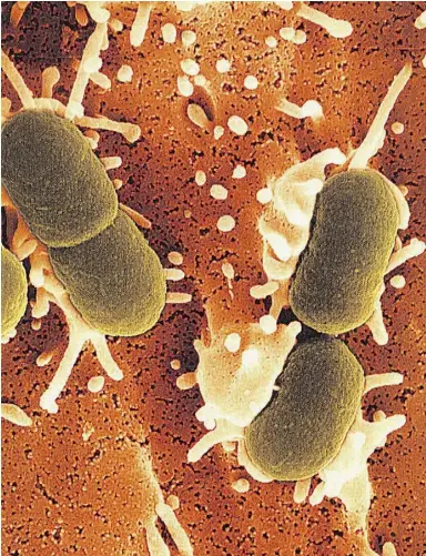  ?? Calgar y Herald files ?? An outbreak of E. coli bacteria (shown) has sickened customers of the Chipotle chain in the U. S. and has since caused the restaurant to lose nearly US$3 billion in market value
as it scrambles to reassure consumers that its food is safe.