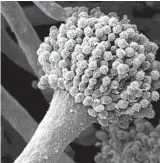  ??  ?? Eine elektronen­mikroskopi­sche Aufnahme des Schimmelpi­lzes Aspergillu­s fumigatus. Foto: HKI