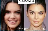  ??  ?? 2011 2017 Kendall