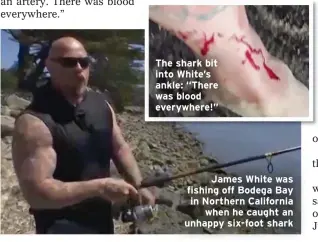  ??  ?? The shark bit into White’s ankle: “There was blood everywhere!”
James White was fishing off Bodega Bay in Northern California
when he caught an unhappy six-foot shark